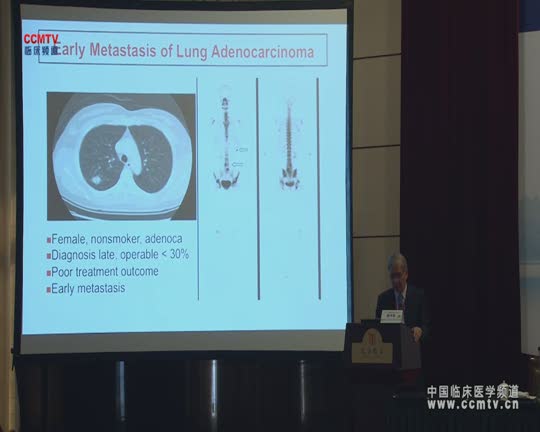 肺癌 诊疗策略 综合治疗 个体化 杨泮池：东亚肺癌个体化治疗的实施：前瞻与未来发展方向