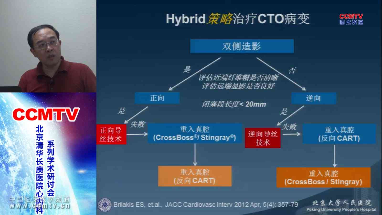 心血管疾病 局部治疗 CTO 王伟民：CTO的治疗新进展