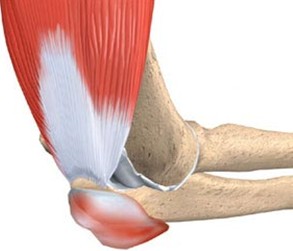 改良张力带技术治疗尺骨鹰嘴骨折