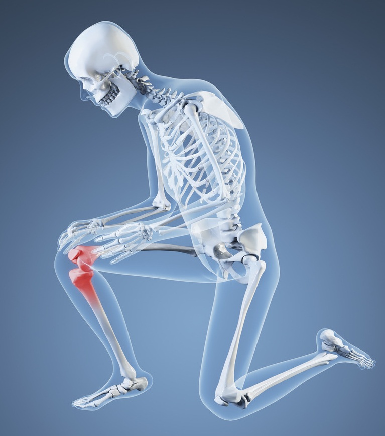 促膝谈膝之全膝关节置换手术 - 骨运动资讯与文摘 - CCMTV临床频道_看临床医学视频、手术视频、病例讨论、医学会议的首选医学视频网官网