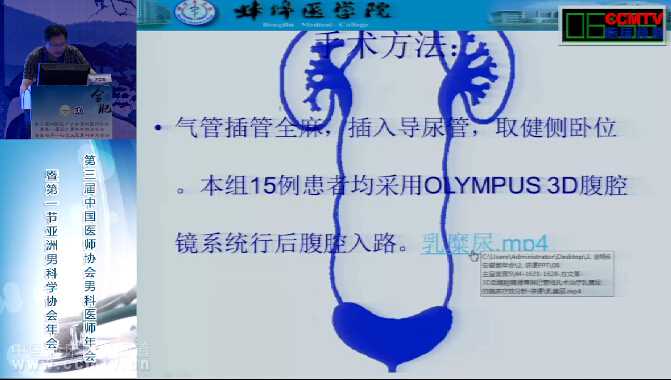 PCN的新进展 - 精彩幻灯 - CCMTV临床频道_看