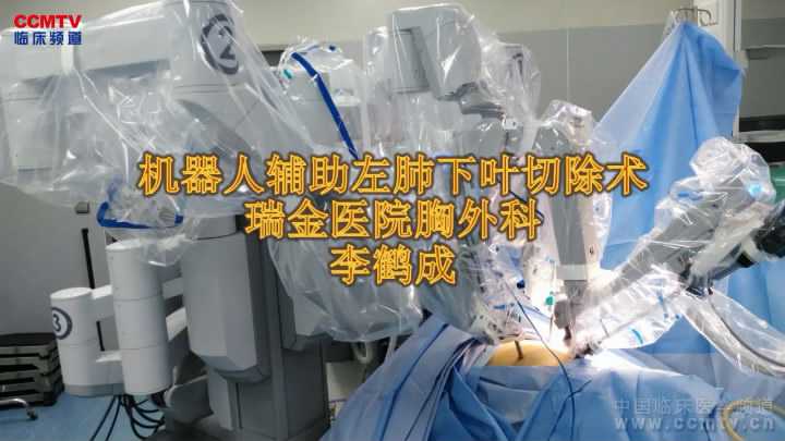 肺癌 手术 微创 机器人 肺叶切除术 李鹤成：达芬奇微创机器人肺癌手术，左下肺叶切除术