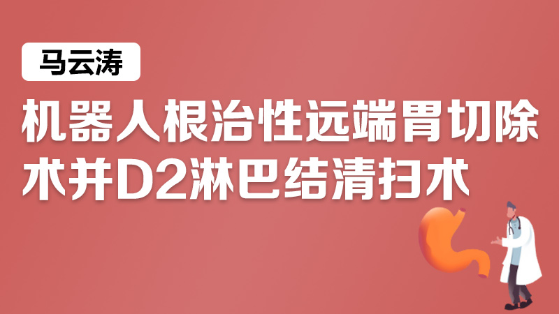 胃癌 机器人 根治性远端胃切除 马云涛：机器人根治性远端胃切除术并D2淋巴结清扫术（Billroth II Braun）