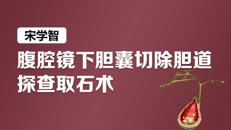 胆囊切除 胆道探查  宋学智：腹腔镜下胆囊切除胆道探查取石术