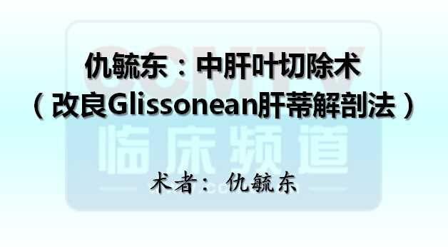 仇毓东：中肝叶切除术（改良Glissonean肝蒂解剖法）