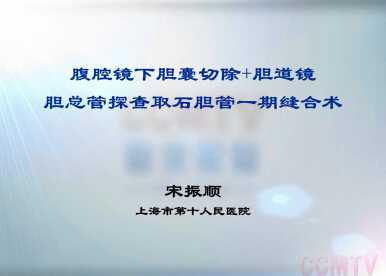 宋振顺：腹腔镜下胆囊切除+胆道镜胆总管探查取石胆管一期缝合术