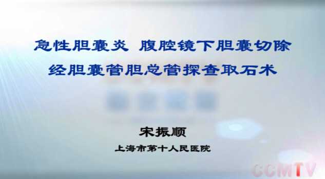 宋振顺：急性胆囊炎腹腔镜下胆囊切除+经胆囊管胆总管探查取石术