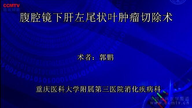 郭鹏：腹腔镜下肝脏左尾状叶肿瘤切除术