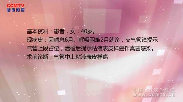 李志刚：气管肿瘤气管一期对端吻合重建术