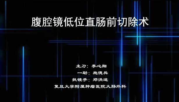 腹腔镜低位直肠前切除术