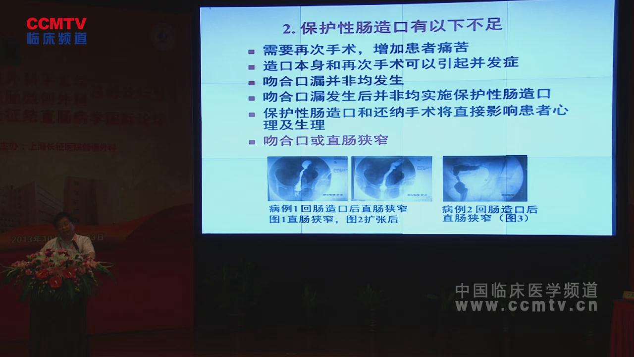 刘宝华：保护性肠造口在结直肠癌手术中应用