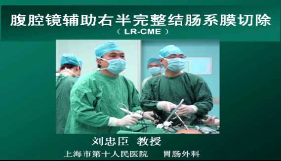 刘忠臣：腹腔镜辅助右半结肠完整系膜切除（LR-CME，含讲解）