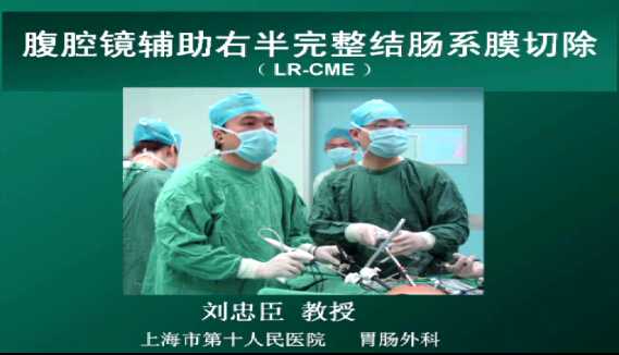 刘忠臣：腹腔镜辅助右半结肠完整系膜切除（LR-CME，含讲解）