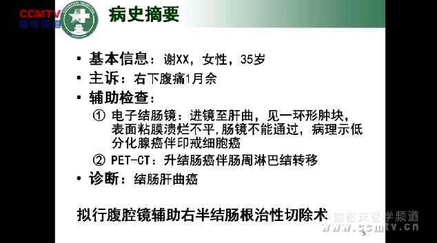 张卫：腹腔镜辅助右半结肠根治性切除术