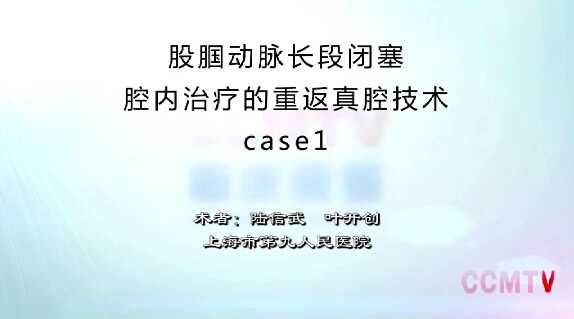 陆信武：股腘动脉长段闭塞腔内治疗的重返真腔技术（含讲解）