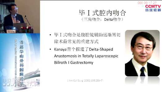 蒿汉坤：腹腔镜下毕I式delta吻合的亚洲实践和华山经验