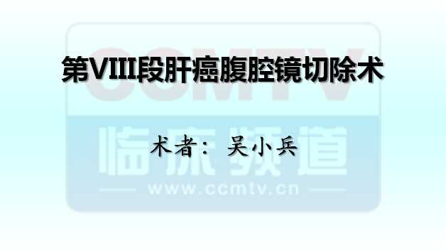 吴小兵：第VIII段肝癌腹腔镜切除术