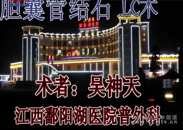 吴神天：胆囊管结石腹腔镜胆囊切除术