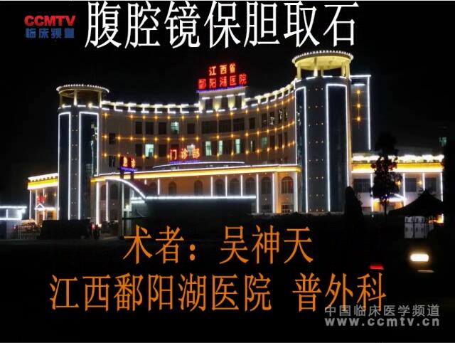 吴神天：腹腔镜保胆取石