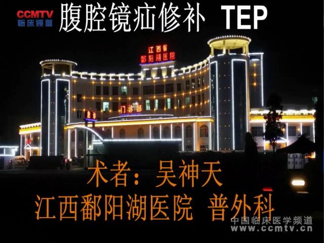 吴神天：腹腔镜疝修补TEP