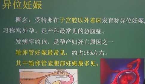 妇产科学：异位产褥