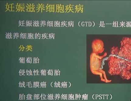 妇产科学：妊娠滋养细胞疾病