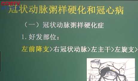 病理学：冠状动脉粥样硬化和冠心病