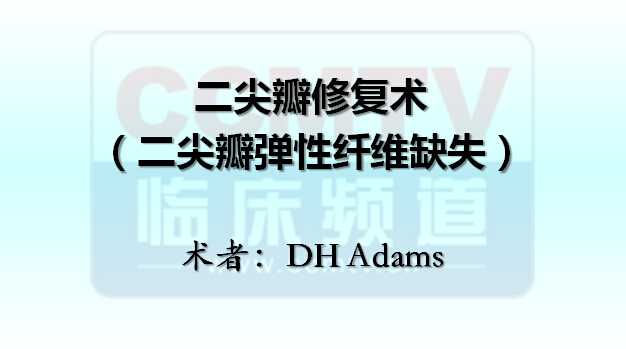 DH Adams：二尖瓣修复术（二尖瓣弹性纤维缺失）