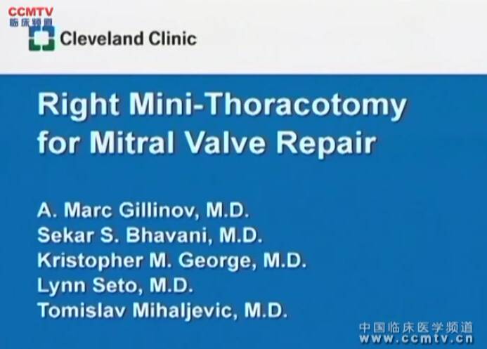 AM Gillinov：右侧微创胸廓切开术修复二尖瓣