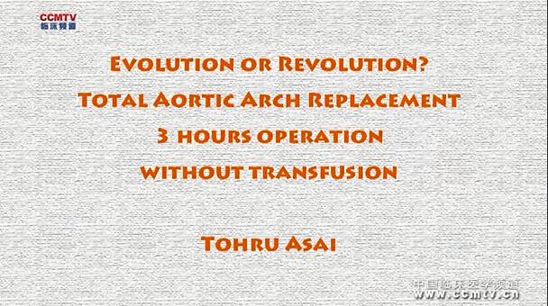 Tohru Asai：总主动脉弓替换3小时操作无输血