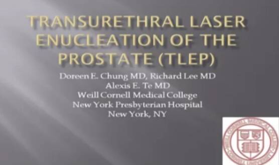 DE Chung：经尿道前列腺激光切除术（TLEP）