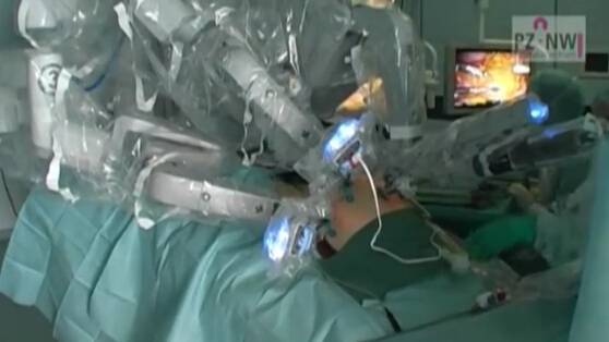 达芬奇机器人前列腺切除术