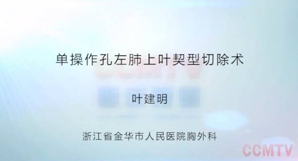 叶建明：单孔胸腔镜左肺叶楔型切除术