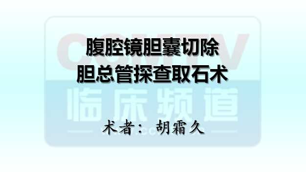 胡霜久：腹腔镜胆囊切除胆总管探查取石术