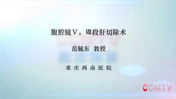 范毓东：腹腔镜V，VIII段肝切除术