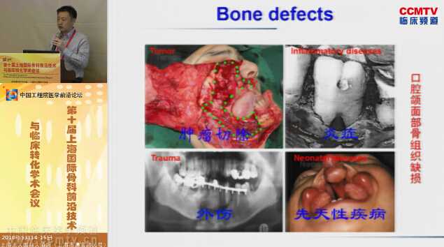 蒋欣泉：颌面部骨组织再生与快速骨整合进展