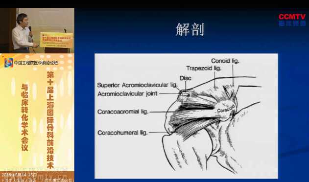 陈建海：肩锁关节脱位与锁骨远端骨折关节镜治疗方案