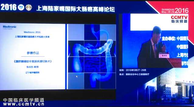 张庆彤：腹腔镜辅助全直肠系膜切除术（含讲解）