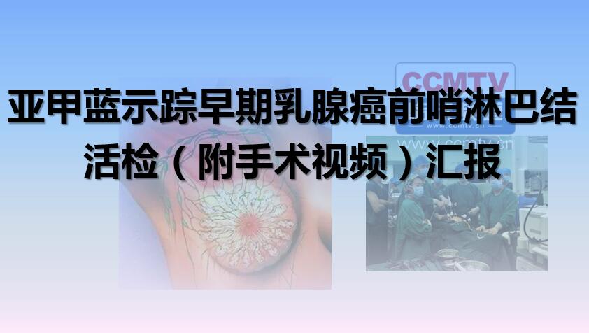 亚甲蓝示踪早期乳腺癌前哨淋巴结活检（附手术视频）汇报