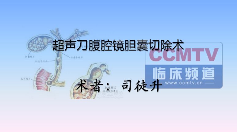 司徒升：超声刀腹腔镜胆囊切除术