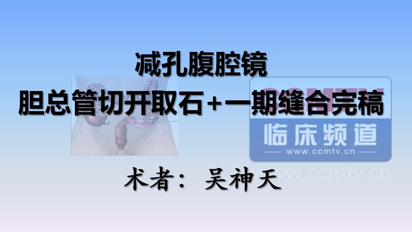 吴神天：减孔腹腔镜胆总管切开取石+一期缝合完稿