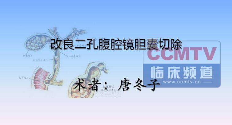 唐冬子：改良二孔腹腔镜胆囊切除