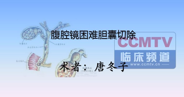 唐冬子：腹腔镜困难胆囊切除