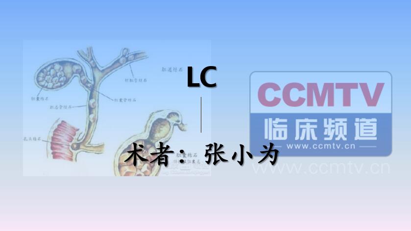 张小为：LC