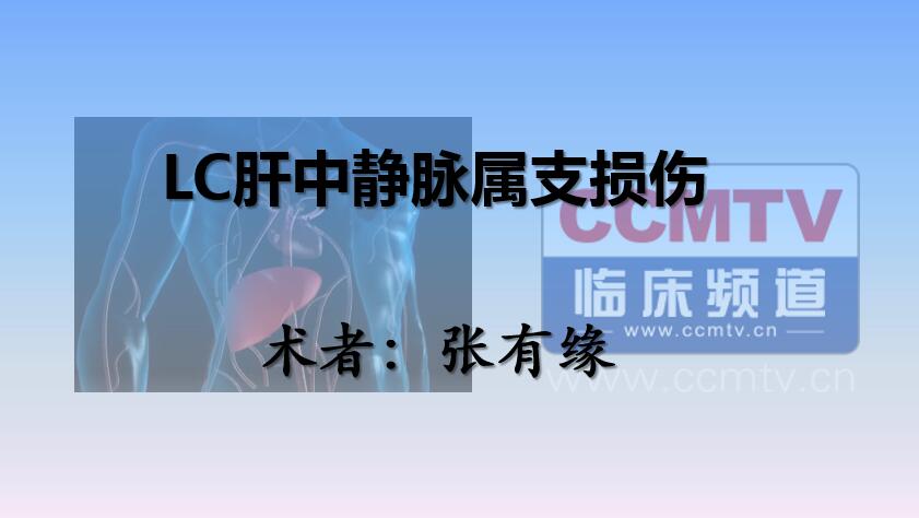 张有缘：LC肝中静脉属支损伤