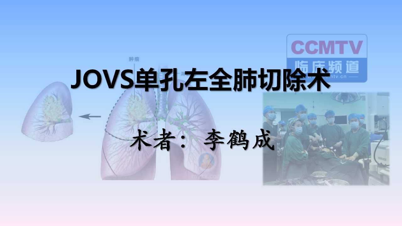 李鹤成：JOVS单孔左全肺切除术