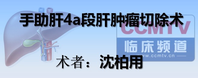 沈柏用：手助肝4a段肝肿瘤切除术