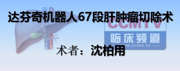 沈柏用：达芬奇机器人67段肝肿瘤切除术