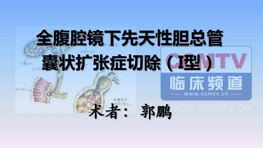 郭鹏：全腹腔镜下先天性胆总管囊状扩张症切除（I型）