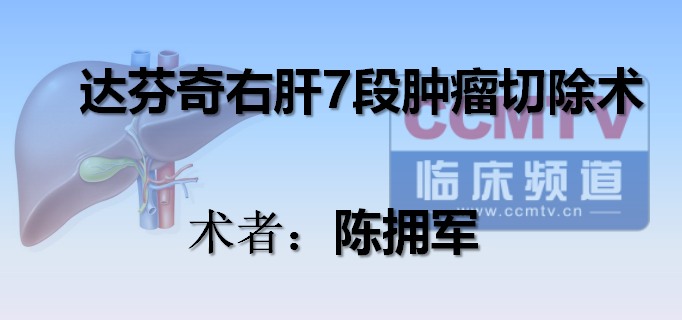 陈拥军：达芬奇右肝7段肿瘤切除术